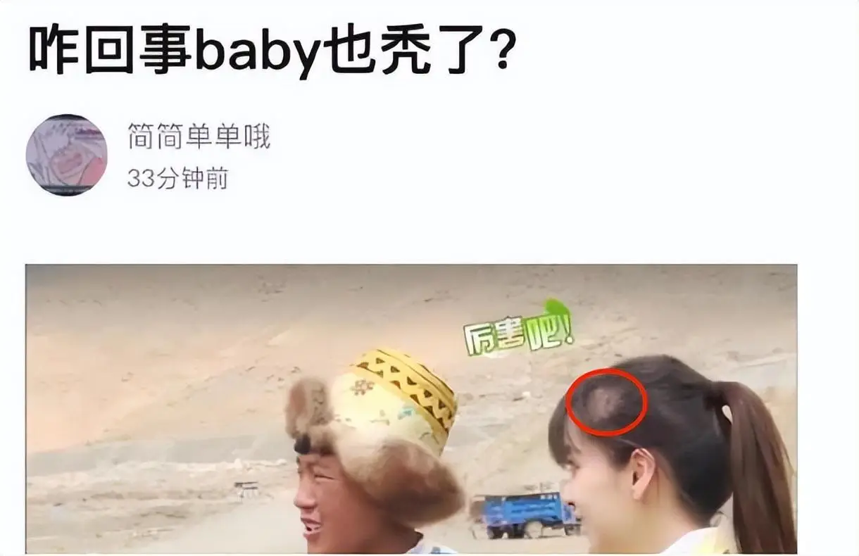 杨幂赵丽颖金晨假发片_发量少的女明星有哪些_女明星脱发严重